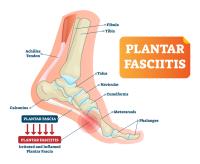 Foot Pain Therapy image 15